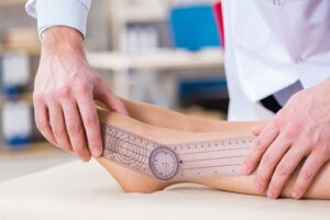 лечение ахондроплазии