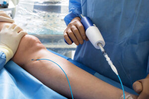 лечение тромбоза