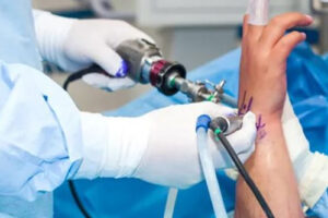 лечение артрита