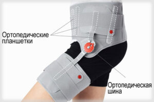 лечение болезни Пертеса