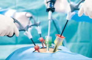 лечение уретероцеле