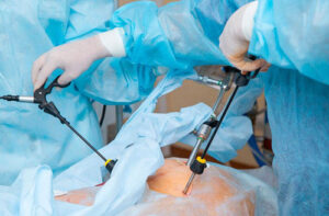 лечение цистита