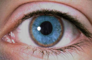 гепатоцеребральная дистрофия