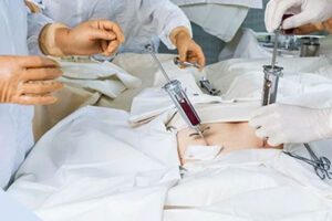 Трансплантация костного мозга