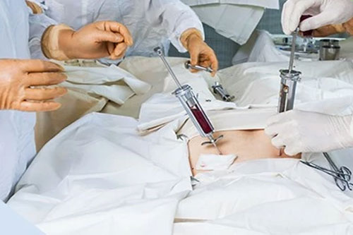 Лечение эритремии в Турции