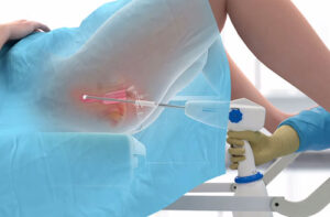 Лечение вестибулита в Турции