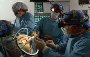 Лечение дендроглиомы в Турции