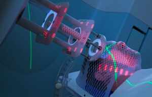 Стереотаксическая хирургия