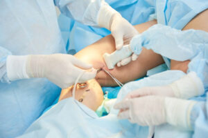 Эмболизация