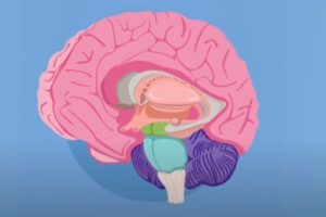 Лечение краниофарингиомы в Израиле