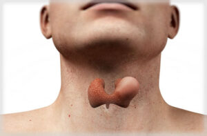 лимфома щитовидной железы