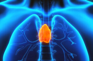 лимфома средостения