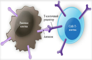 Лечение лимфомы средостения
