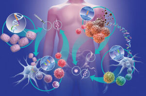 лечение неходжкинской лимфомы