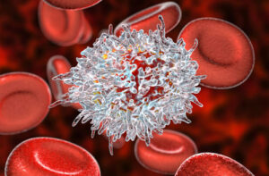 волосатоклеточный лейкоз