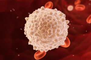 Лечение гематосаркомы в Германии