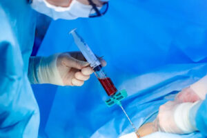 Трансплантация костного мозга