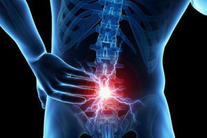 Лечение метастазов в позвоночнике в Германии