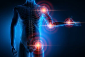 Лечение опухолей опорно-двигательного аппарата в Германии