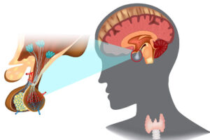 Лечение аденомы гипофиза в Германии
