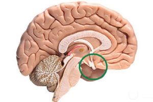 Лечение микроаденомы гипофиза в Германии