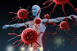 Иммунотерапия