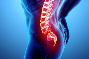 Лечение синдрома конского хвоста в Германии