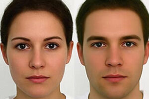 Лечение синдрома тестикулярной феминизации в Турции