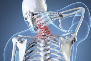 Лечение вертебрально-базилярной недостаточности в Германии