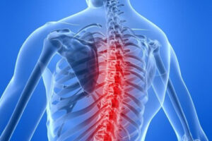 Лечение травмы спинного мозга в Германии