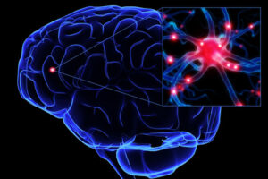 Лечение лейкодистрофии в Германии