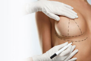 консультация с хирургом