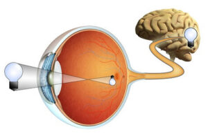 Лечение атрофии зрительного нерва в Германии