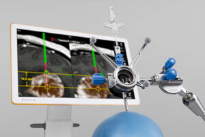Сосудистая навигация 