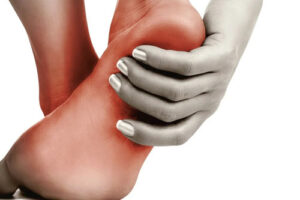 Лечение диабетической ангиопатии в Германии