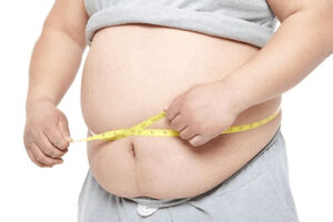 Лечение ожирения в Турции