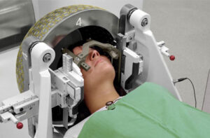 лечение невриномы