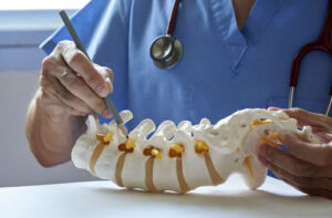 остеохондрома позвоночника