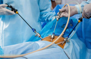 лечение кисты желчного пузыря