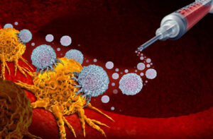 Лечение тератомы