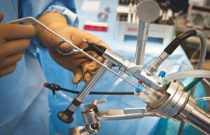 лечение полипоза прямой кишки