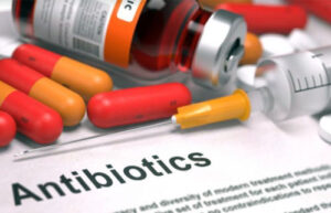 лечение парапроктита