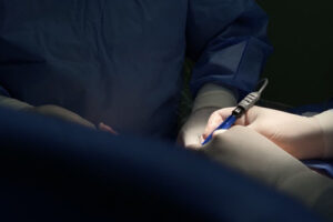 Лазерная коррекция