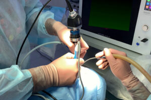 Эндоскопическая коррекция