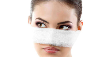 Ринопластика