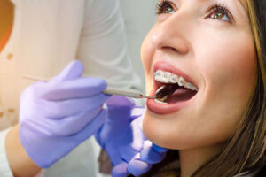 Ортодонтическое лечение