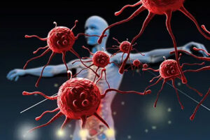 Иммунотерапия