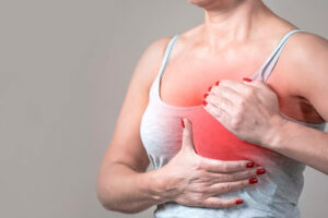 Лечение апокринного рака в Турции