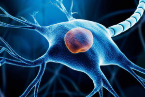 Лечение недифференцированной плеоморфной саркомы в Турции