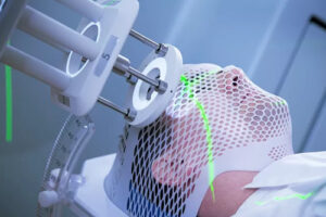 Протонная терапия